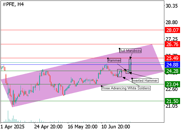 PFE: Candlestick Analysis Points to Major Upside