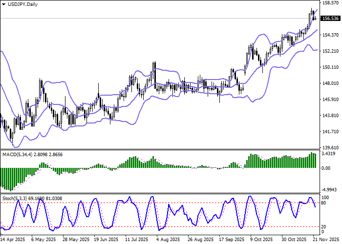USD/JPY chart